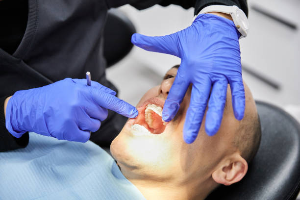 Best Emergency Wisdom Teeth Removal in Scappoose, OR